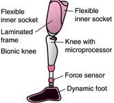 A screw anchored intramedullary hip stem